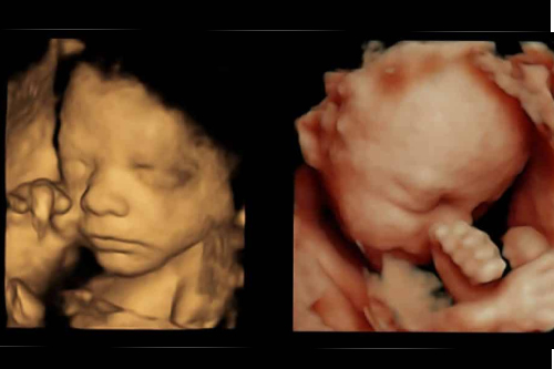 4d scan in womb baby process in pregnancy shows