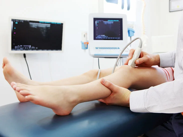 Doppler ultrasound