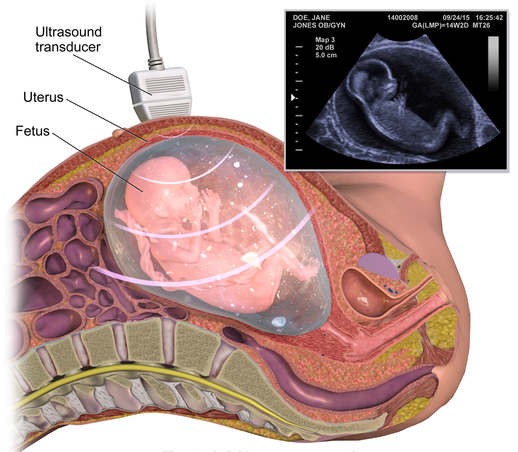 Fetal imaging in nagpur