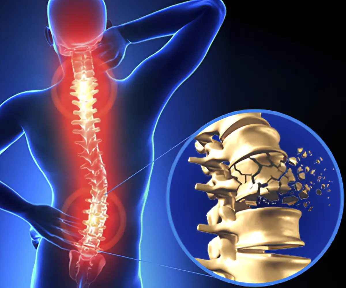 Spinal trauma In Nagpur