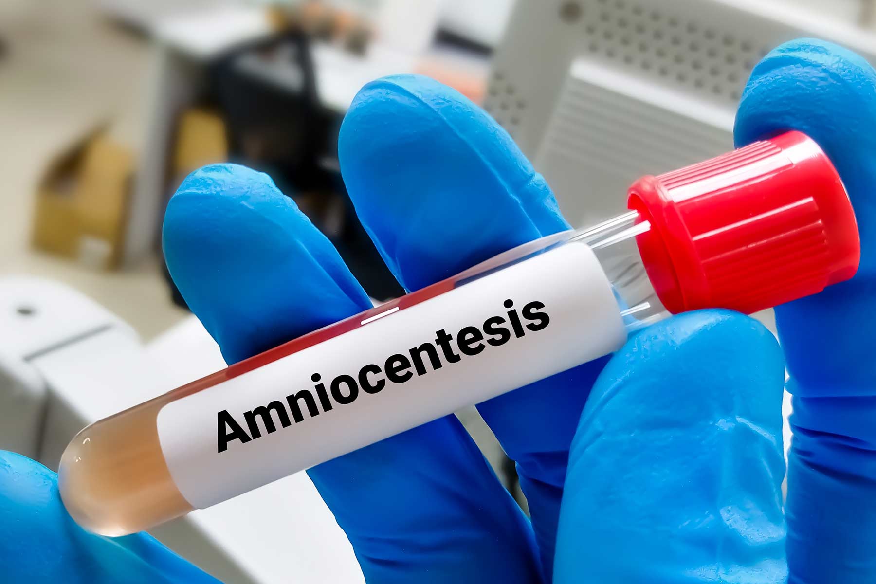 Amniocentesis in nagpur