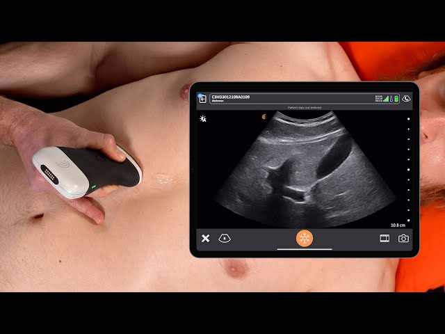 Gallbladder ultrasound in nagpur