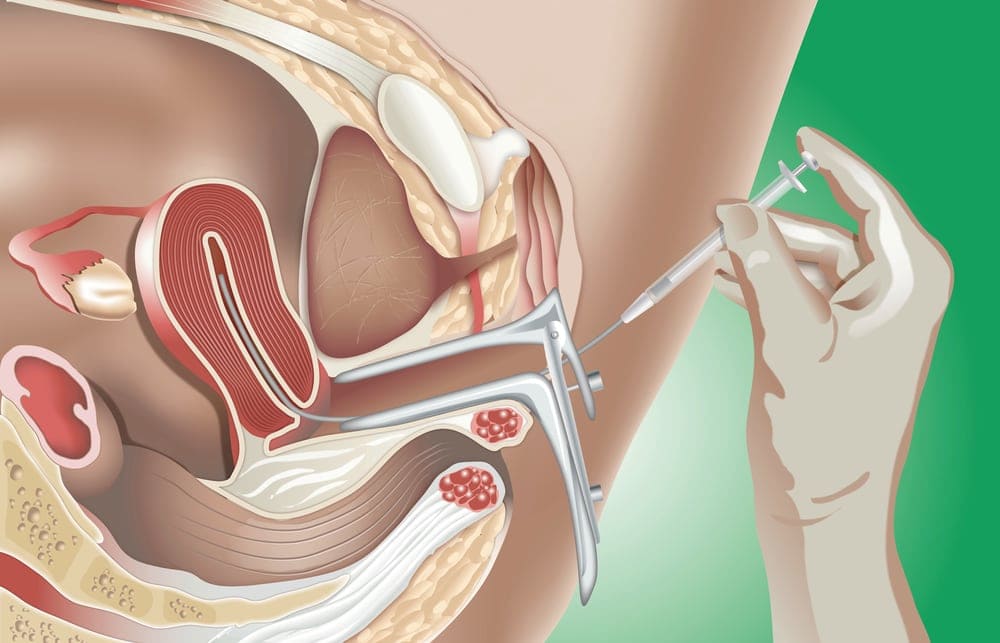 Intrauterine Interventions in nagpur