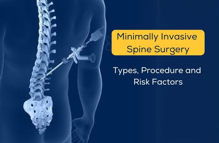 Minimally-Invasive-Spine-Surgery In Nagpur