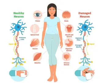 Multiple Sclerosis In Nagpur