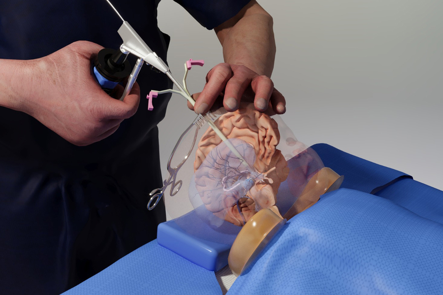 Neurosurgical innovations in nagpur