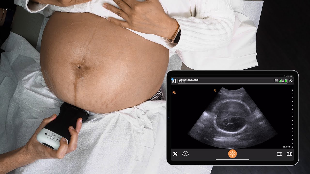 Obstetric Ultrasound In Nagpur