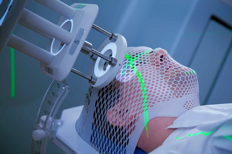 Stereotactic Surgery In Nagpur