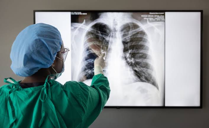 Thoracic spine surgery in nagpur
