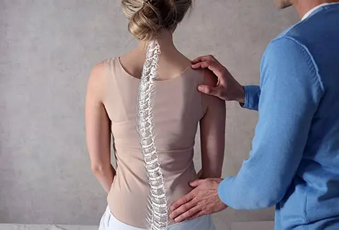 kyphosis in nagpur