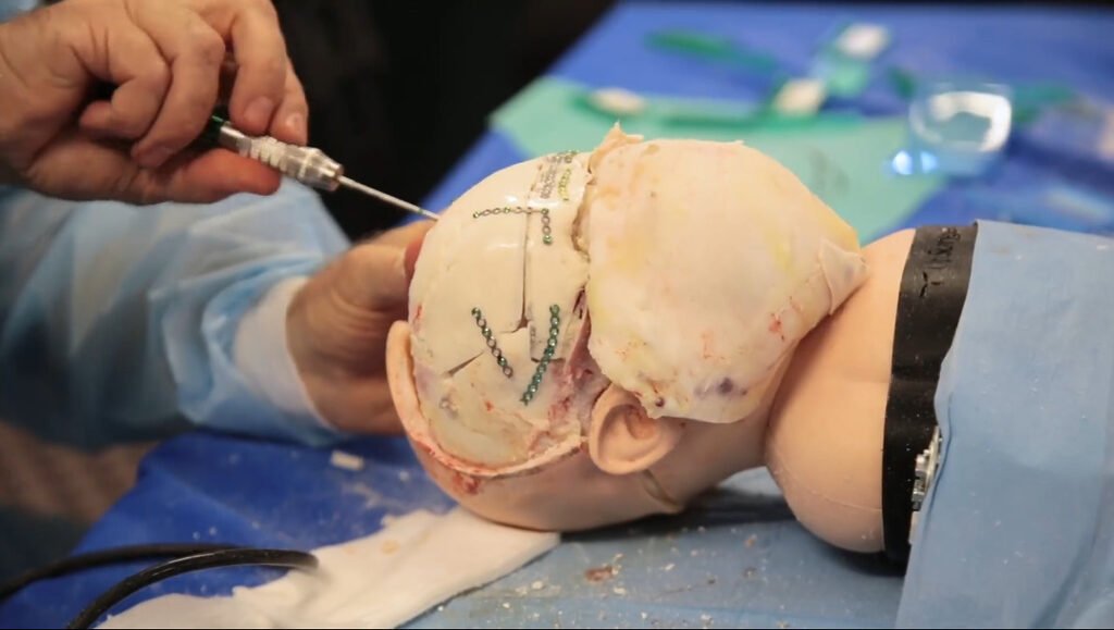 Brain surgeon in katni